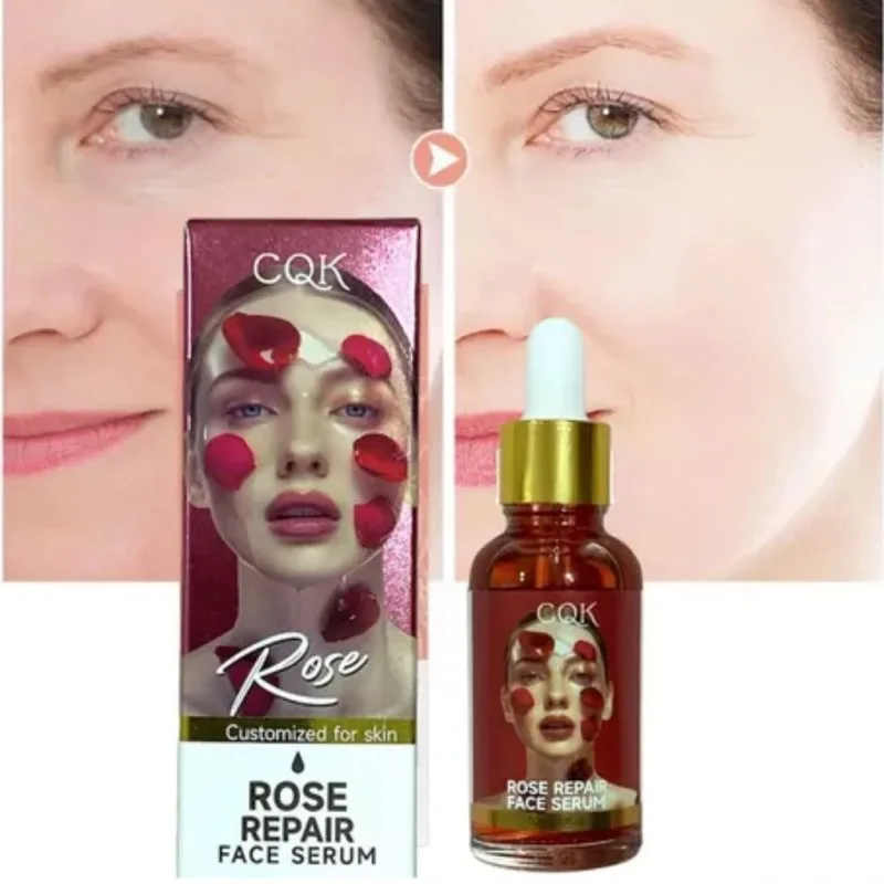 SÉRUM DE ROSAS